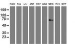 GOLM1 Antibody in Western Blot (WB)