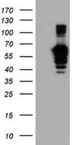 GOLM1 Antibody in Western Blot (WB)