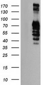 GOLM1 Antibody in Western Blot (WB)