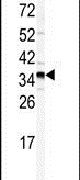 GOLPH3 Antibody in Western Blot (WB)