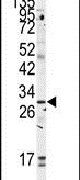 GOLPH3 Antibody in Western Blot (WB)
