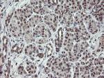 GORAB Antibody in Immunohistochemistry (Paraffin) (IHC (P))