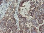 GORAB Antibody in Immunohistochemistry (Paraffin) (IHC (P))