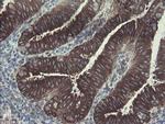 GORAB Antibody in Immunohistochemistry (Paraffin) (IHC (P))