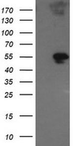 GORAB Antibody in Western Blot (WB)