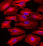 Rat IgG (H+L) Highly Cross-Adsorbed Secondary Antibody in Immunocytochemistry (ICC/IF)