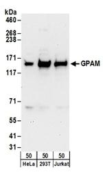 GPAM Antibody in Western Blot (WB)