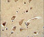 Glypican 5 Antibody in Immunohistochemistry (IHC)