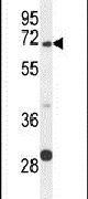 Glypican 5 Antibody in Western Blot (WB)