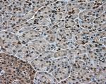 GPI Antibody in Immunohistochemistry (Paraffin) (IHC (P))