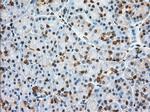 GPI Antibody in Immunohistochemistry (Paraffin) (IHC (P))