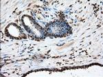 GPI Antibody in Immunohistochemistry (Paraffin) (IHC (P))