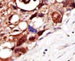 PIGK Antibody in Immunohistochemistry (IHC)