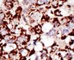PIGK Antibody in Immunohistochemistry (IHC)