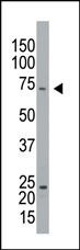 GPIP137 Antibody in Western Blot (WB)