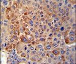 GPLD1 Antibody in Immunohistochemistry (IHC)