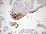 GPNMB Antibody in Immunohistochemistry (Paraffin) (IHC (P))