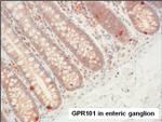 GPR101 Antibody in Immunohistochemistry (Paraffin) (IHC (P))