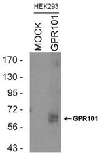 GPR101 Antibody in Western Blot (WB)