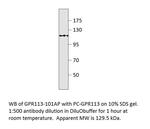GPR113 Polyclonal Antibody
