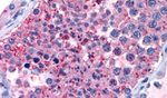 GPR133 Antibody in Immunohistochemistry (Paraffin) (IHC (P))