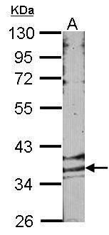GPR146 Antibody in Western Blot (WB)