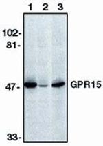 GPR15 Antibody in Western Blot (WB)