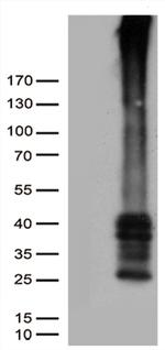 GPR151 Antibody in Western Blot (WB)