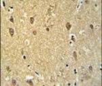 GPR17 Antibody in Immunohistochemistry (IHC)