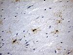 GPR17 Antibody in Immunohistochemistry (Paraffin) (IHC (P))