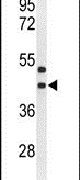 GPR17 Antibody in Western Blot (WB)