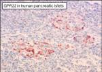 GPR22 Antibody in Immunohistochemistry (Paraffin) (IHC (P))