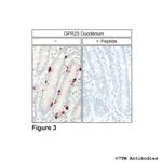 GPR25, G protein-coupled Receptor 25 Antibody in Immunohistochemistry (Paraffin) (IHC (P))