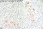 GPR25 Antibody in Immunohistochemistry (Paraffin) (IHC (P))