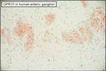 GPR31 Antibody in Immunohistochemistry (Paraffin) (IHC (P))