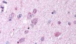 GPR37 Antibody in Immunohistochemistry (Paraffin) (IHC (P))