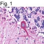 GPR39 Antibody in Immunohistochemistry (IHC)