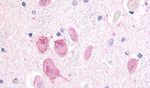 GPR45 Antibody in Immunohistochemistry (Paraffin) (IHC (P))