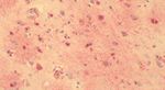 GPR56 Antibody in Immunohistochemistry (Paraffin) (IHC (P))
