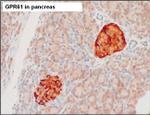GPR61 Antibody in Immunohistochemistry (Paraffin) (IHC (P))