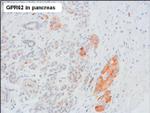 GPR62 Antibody in Immunohistochemistry (Paraffin) (IHC (P))