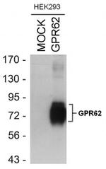 GPR62 Antibody in Western Blot (WB)
