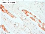 GPR82 Antibody in Immunohistochemistry (Paraffin) (IHC (P))