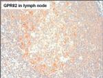 GPR82 Antibody in Immunohistochemistry (Paraffin) (IHC (P))