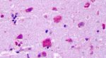 GPR83 Antibody in Immunohistochemistry (Paraffin) (IHC (P))