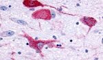 GPR83 Antibody in Immunohistochemistry (Paraffin) (IHC (P))