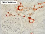 GPR87 Antibody in Immunohistochemistry (Paraffin) (IHC (P))