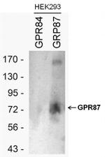 GPR87 Antibody in Western Blot (WB)