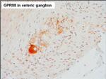 GPR88 Antibody in Immunohistochemistry (Paraffin) (IHC (P))