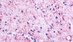 GPRC5C Antibody in Immunohistochemistry (Paraffin) (IHC (P))